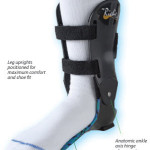 Ankle instability depicted by a person's foot with an ankle brace.