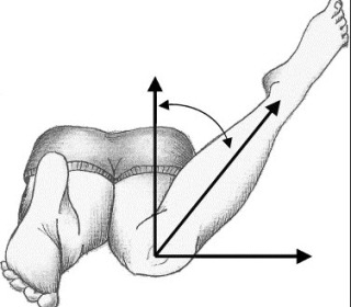 femoral anteversion exam - Advanced Foot And Ankle Center Of San Diego