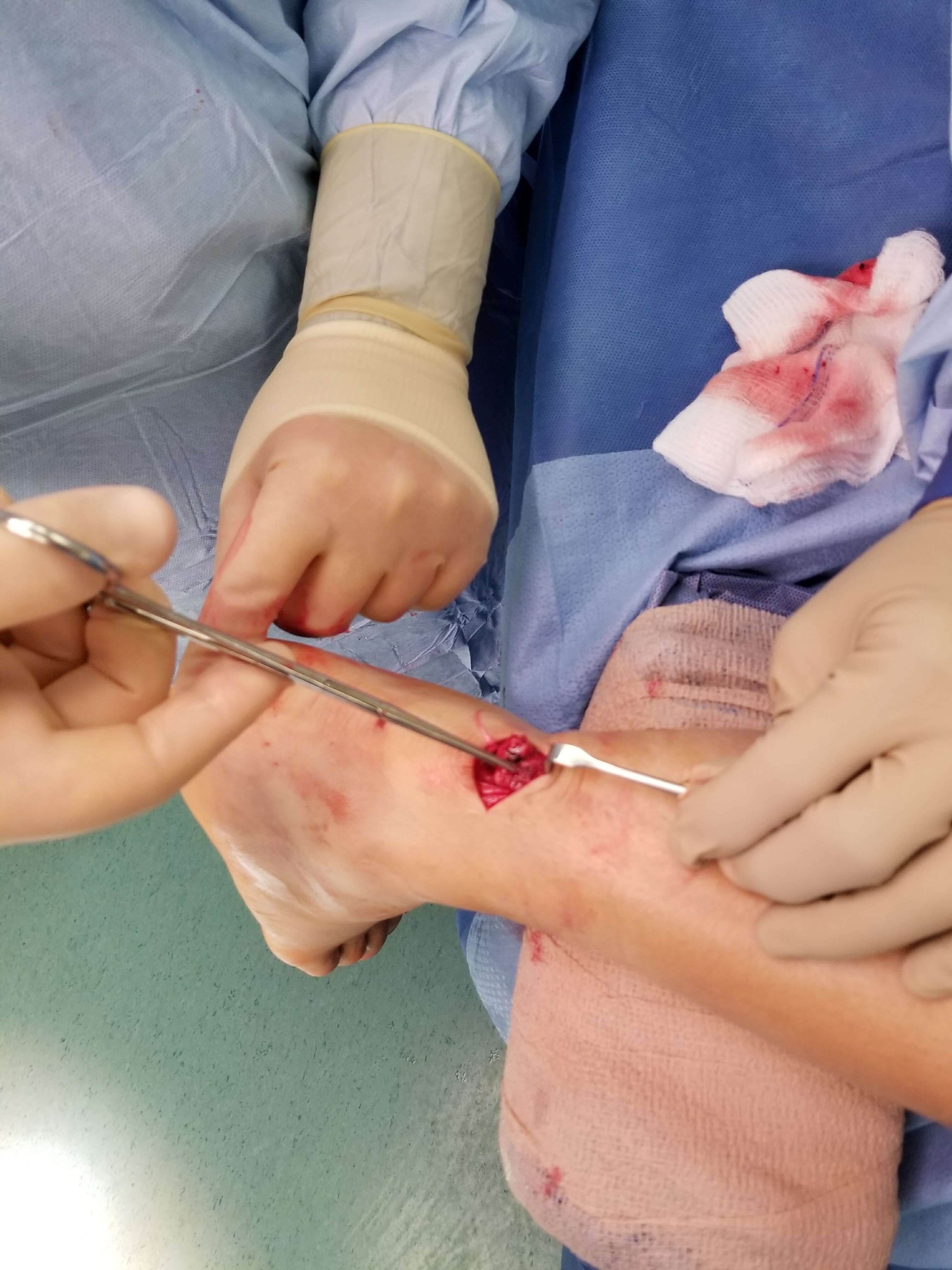 Surgical procedure on a patient's leg.