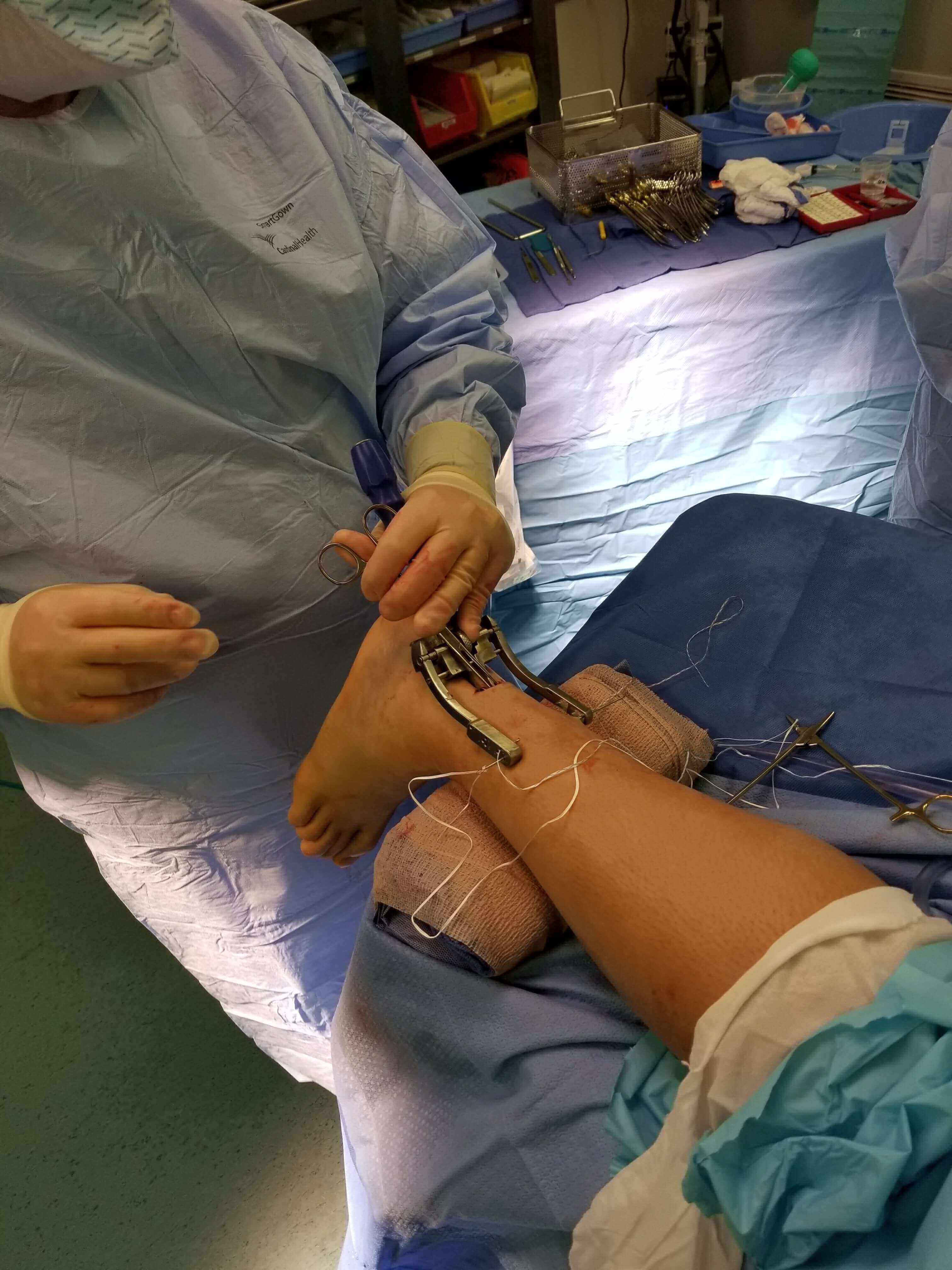 Surgeon stitching a patient's leg.