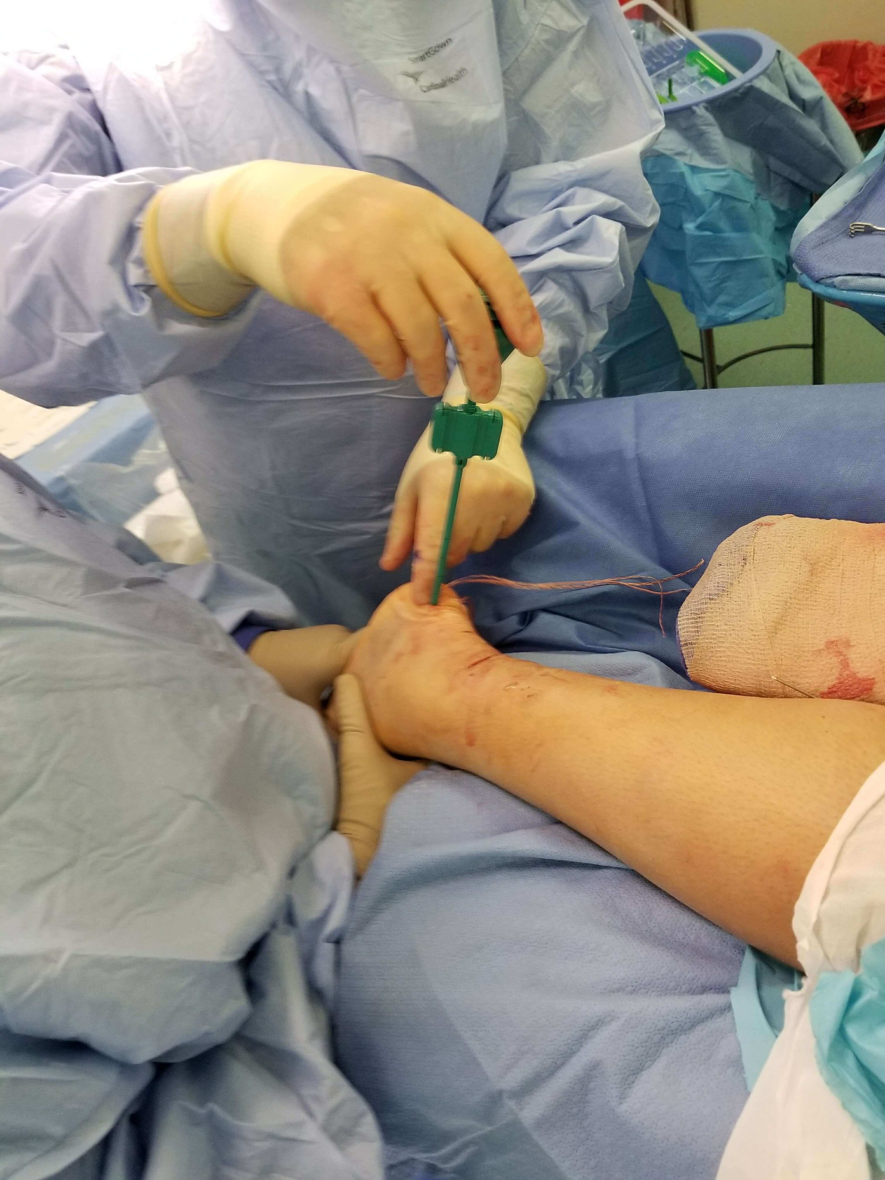 A surgeon places a tourniquet on a patient's arm.