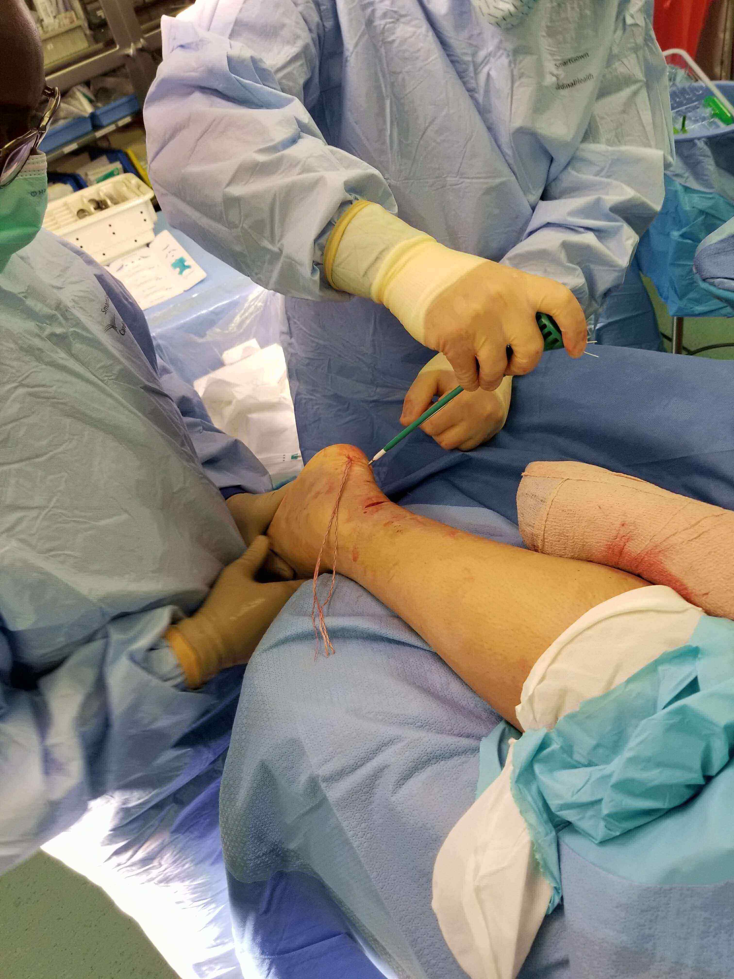 Surgeon operating on a patient's leg.