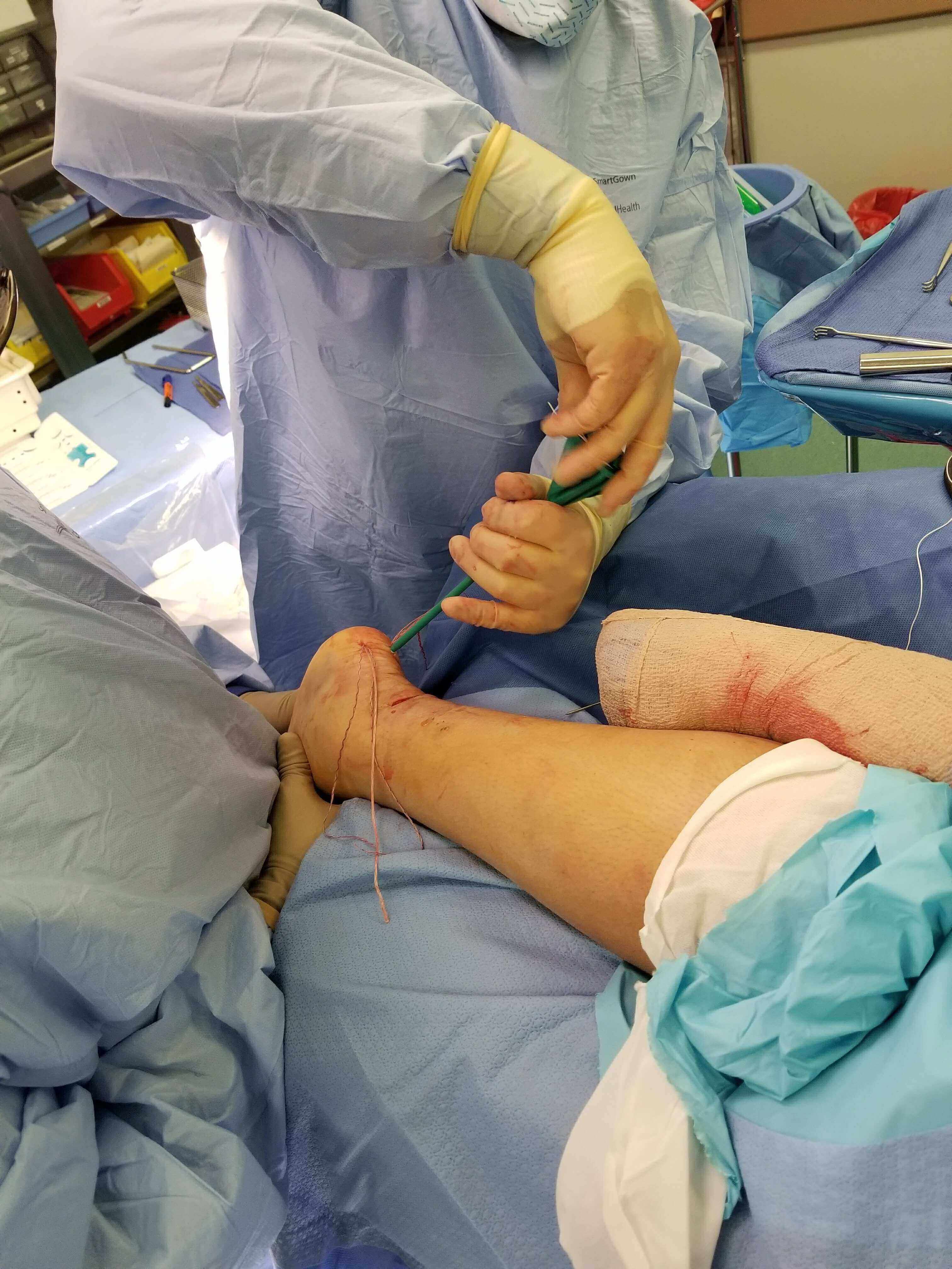 Surgeon stitching a wound on a patient's arm.